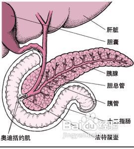 胆总管结石会癌变吗